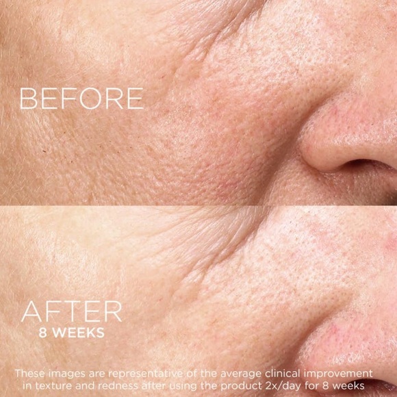 $8❤️‍🔥 DARPHIN Paris Intral Inner Youth Rescue Serum 🪞 NEW IN BOX - Picture 7 of 10